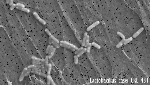 Animal study: probiotic Lactobacillus casei CRL431 inhibits metastatic breast cancer