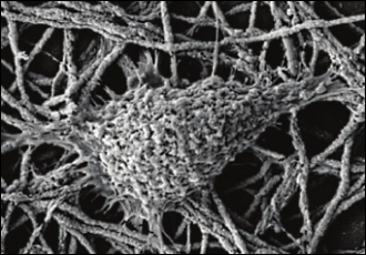 Physical exercise may improve lung cancer survival chances