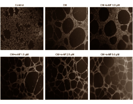 Alpha-napthoflavone, the sly fat-maker in testosterone boosters