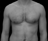 Male body hair a turn off for fertile women