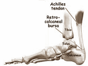 Strength athletes who use anabolic steroids non-stop are almost bound to develop tendon problems, including the risk of tearing them. Brazilian physiologists came to this conclusion after doing experiments with rats. They believe that steroids, while boosting post-training muscle growth, also prevent muscle attachments from becoming stronger.