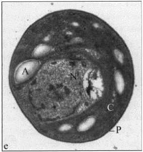 Supplements containing the microalgae Chlorella can probably reduce your chances of developing cardiovascular disease. At least the results of a Japanese human study published in the Journal of Clinical Biochemistry and Nutrition would suggest this. According to this study, Chlorella makes the blood vessels suppler.