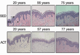 Lazy bones who takes up exercise rejuvenates skin