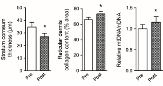 Lazy bones who takes up exercise rejuvenates skin