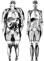 Chemical weight loss won't lift depression