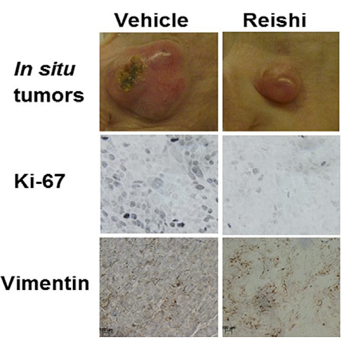 Reishi | A spoke in the wheel of aggressive breast cancer