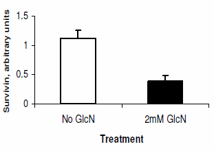 Glucosamine inhibits tough kinds of cancer