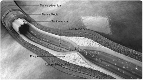 Strength athletes' heart and blood vessels can take a couple of eggs for breakfast
