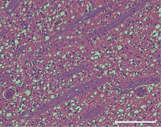 Mad deer disease can be transmitted to primates