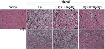 Hesperidin stimulates formation of new muscle tissue
