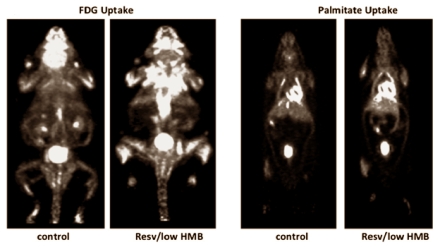Resveratrol-leucine combo boosts fat burning