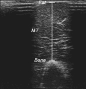 Muscle group you train first grows fastest
