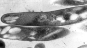 Aids bacteria Mycobacterium fortuitum causes abscess in bodybuilder