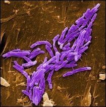 Aids bacteria Mycobacterium fortuitum causes abscess in bodybuilder