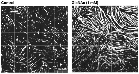 Acetylglucosamine accelerates the formation of muscle fibers