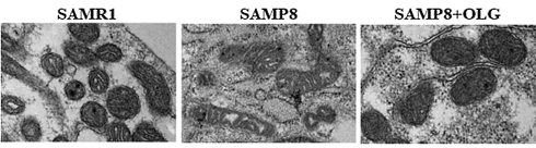 Oligonol, a muscle-building supplement based on lychees