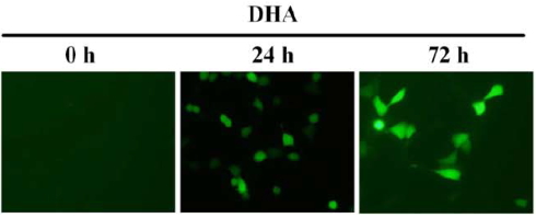 Omega-3 fatty acids sabotage breast cancer cells by boosting free radicals