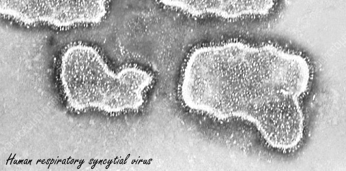 The antiviral effect of fresh ginger