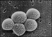 Monstrous abscesses after trenbolone injections