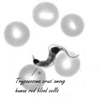 Arginine arms immune system against 'the new Aids'