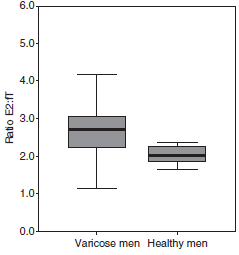 Raised estradiol level gives men varicose veins