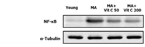 Aging without wrinkles due to vitamin C supplementation