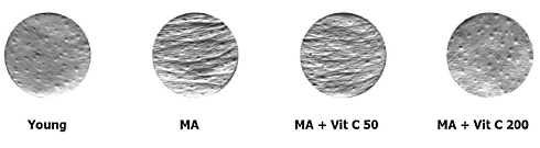 Aging without wrinkles due to vitamin C supplementation