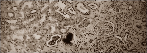 Bodybuilder poisons himself with vitamin D